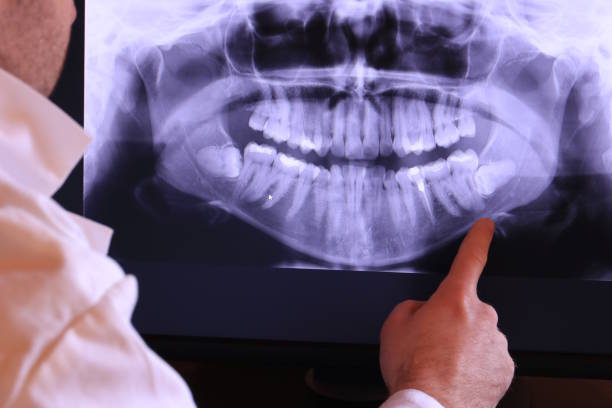 Best Emergency Dental Surgery in Blue Mountain, MS