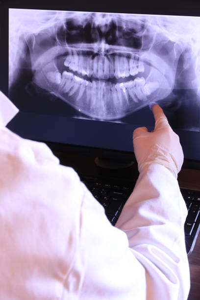 Best Emergency Wisdom Teeth Removal in Blue Mountain, MS