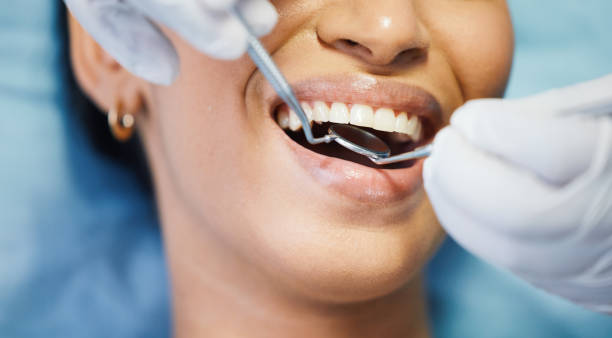 Best Emergency Treatment for Toothache in Blue Mountain, MS